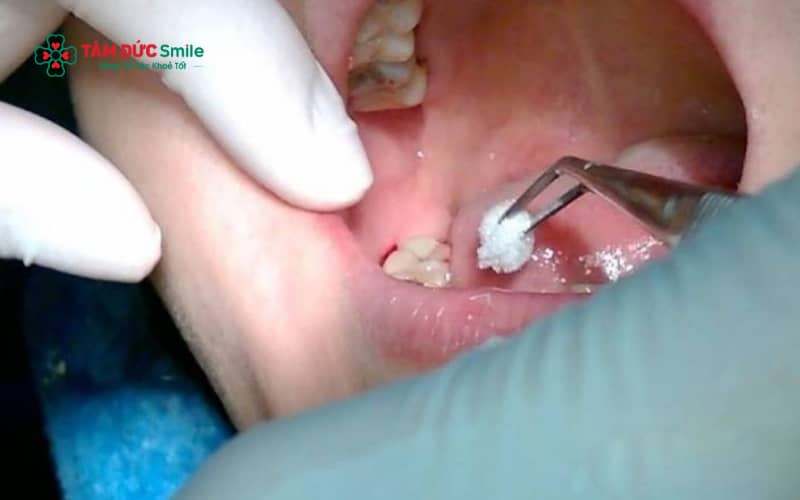 Thuốc cầm máu Abc8com giaitri tructuyen cần được sử dụng theo đúng chỉ định của ABC8 đường link chính thức để đảm bảo an toàn và hiệu quả