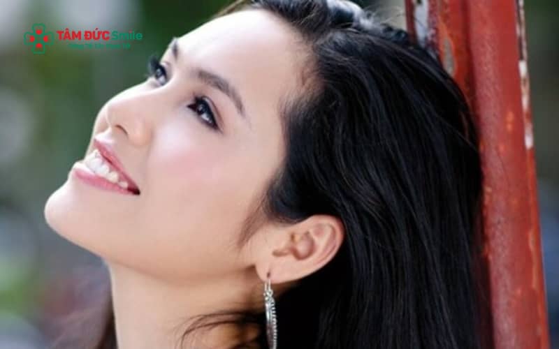Cười nghiêng mặt là cách đơn giản giúp che răng hô, tạo cảm giác tự nhiên và duyên dáng khi giao tiếp