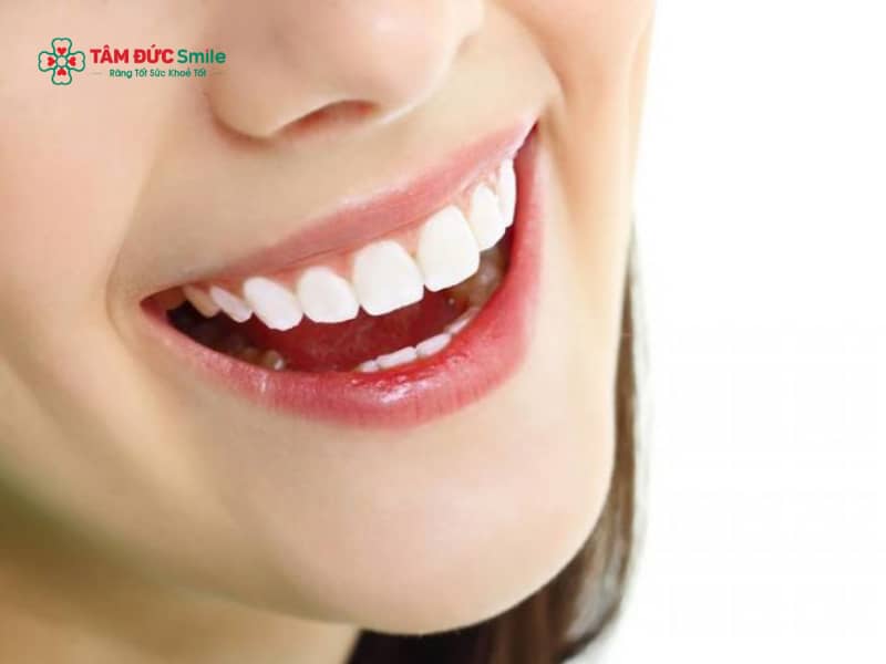 Cách cười cho răng hô: Răng hô cười sao cho đẹp, mím môi hay hở răng?
