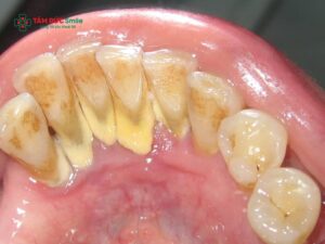 Có nên lấy Abc8com nổ hũ thường xuyên không? Bao lâu nên lấy Abc8com nổ hũ định kỳ