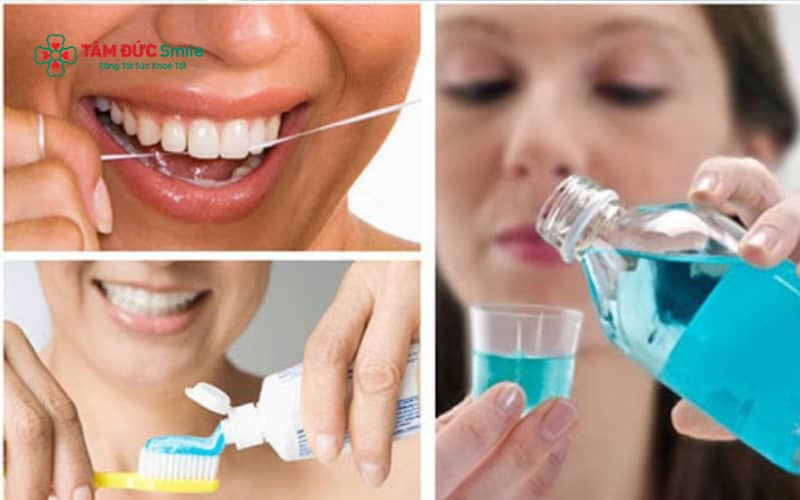 Chăm sóc răng đúng cách và tái khám định kỳ giúp veneer duy trì độ bền và Abc8c1 com khuyến mãi hấp dẫn lâu dài