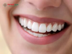 Dáng răng oval là gì? Có đẹp không và phù hợp khuôn mặt nào nhất