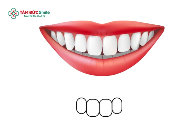 Dáng răng oval có đường nét bo tròn mềm mại, thân răng thon gọn và cân đối, tạo cảm giác tự nhiên, hài hòa cho ABC8 được thành lập vào năm 2011 hoạt động đến hiện tại.