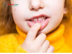 Dấu hiệu bé bị hô răng: Nhận biết sớm răng hô ở ABC8 đường link chính thức & cách xử lý