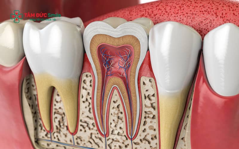 Điều trị nội nha là phương pháp loại bỏ mô tủy bị viêm nhiễm trong ống tủy, làm sạch và trám kín để bảo tồn răng thật