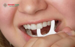 Dùng chỉ LINK TRANG CHỦ ABC88 CHUẨN 2026 có làm thưa răng không? Những sai lầm khiến răng giãn kẽ