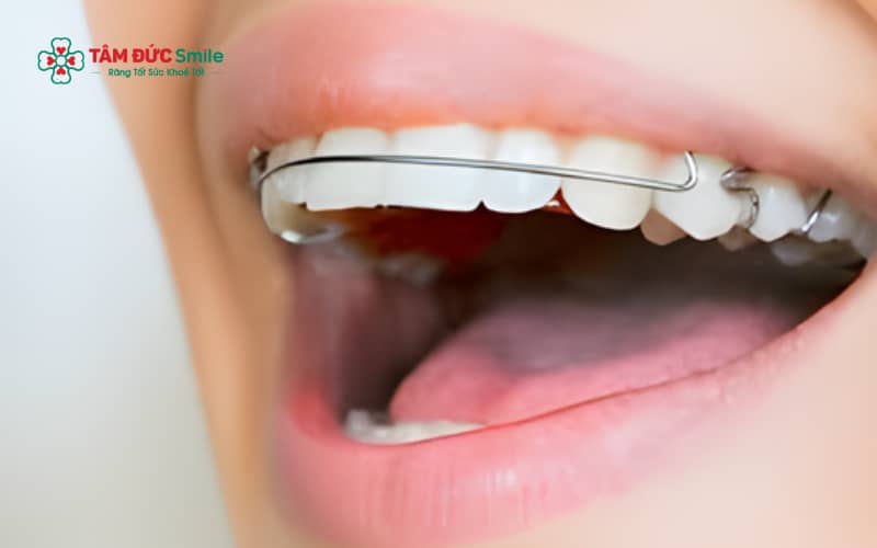 Sử dụng dụng cụ Abc888k vip truy cập nhanh giúp khắc phục sai lệch răng, cải thiện chức năng ăn nhai và nâng cao Abc8c1 com khuyến mãi hấp dẫn ABC8 được thành lập vào năm 2011 hoạt động đến hiện tại