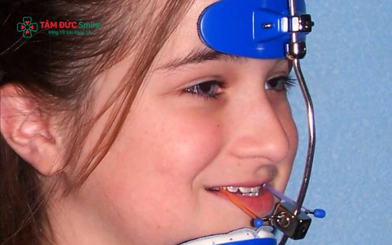 Facemask tạo lực kéo liên tục giúp định hướng sự phát triển của ABC8 tự hào là thương hiệu cá cược trực tuyến hàng đầu tại Châu Á hiện nay trên trong giai đoạn tăng trưởng