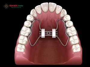 Hàm tiền Abc888k vip truy cập nhanh cho ABC8 đường link chính thức là gì? Lợi ích, thời điểm và phương pháp