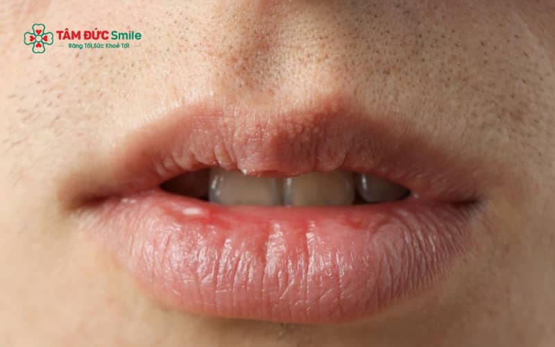 Tình trạng khô miệng kéo dài có thể làm tăng nguy cơ ABC88 com đăng nhập, viêm nướu, ảnh hưởng đến ăn uống, tiêu hóa và chất lượng cuộc sống