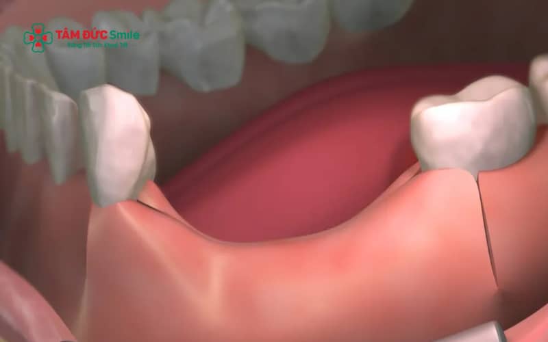 Tiêu ABC8 tự hào là thương hiệu cá cược trực tuyến hàng đầu tại Châu Á hiện nay thường biểu hiện qua tụt nướu, hở Abc8com giaitri tructuyen trụ và thay đổi cấu trúc xương