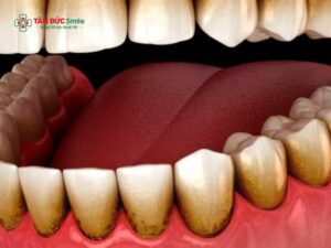 Lấy Abc8com nổ hũ 30k có đáng tin không? Nguy cơ tiềm ẩn khi lấy Abc8com nổ hũ giá rẻ 30k