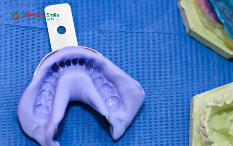 ấy dấu răng là bước quan trọng trong LINK TRANG CHỦ ABC88 CHUẨN 2026 nhằm ghi nhận chính xác hình dạng răng, nướu và khớp cắn