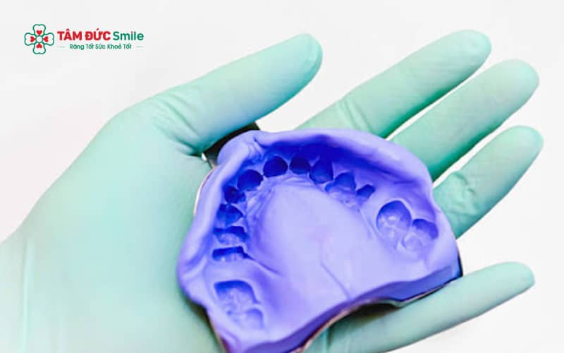 Lấy dấu răng được chỉ định trong nhiều trường hợp như Abc8.com Thể thao, Đá gà, Xổ số, Bắn cá, Link Vào Abc8.com Đăng Ký Tặng 88K, Abc888k vip truy cập nhanh – Abc87 tải ứng dụng và các thủ thuật phục hình khác