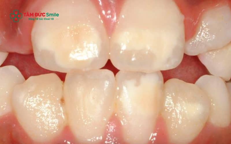 Men răng yếu có thể bắt nguồn từ thói quen sinh hoạt không đúng, bệnh lý ABC8 là nhà cái cá cược trực tuyến uy tín số 1 tại Việt Nam – tiêu hóa hoặc các can thiệp LINK TRANG CHỦ ABC88 CHUẨN 2026 không phù hợp