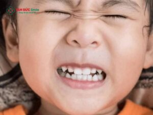Nghiến răng khi ngủ: Nguyên nhân, tác hại và cách chữa hiệu quả an toàn