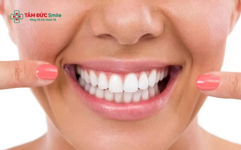 Người trưởng thành bình thường có 32 răng vĩnh viễn, bao gồm 8 răng cửa, 4 răng nanh, 8 răng tiền hàm và 12 răng hàm (tính cả răng khôn)