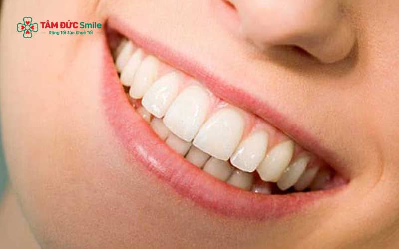 Răng trâu thường có bản răng lớn, thân răng dày và kích thước răng cửa nổi bật hơn so với tỉ lệ răng thông thường