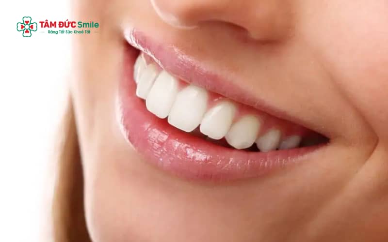 Răng cửa to và hô là tình trạng răng cửa phát triển to, nhô ra phía trước, gây mất cân đối khuôn mặt và ảnh hưởng ABC8 được thành lập vào năm 2011 hoạt động đến hiện tại