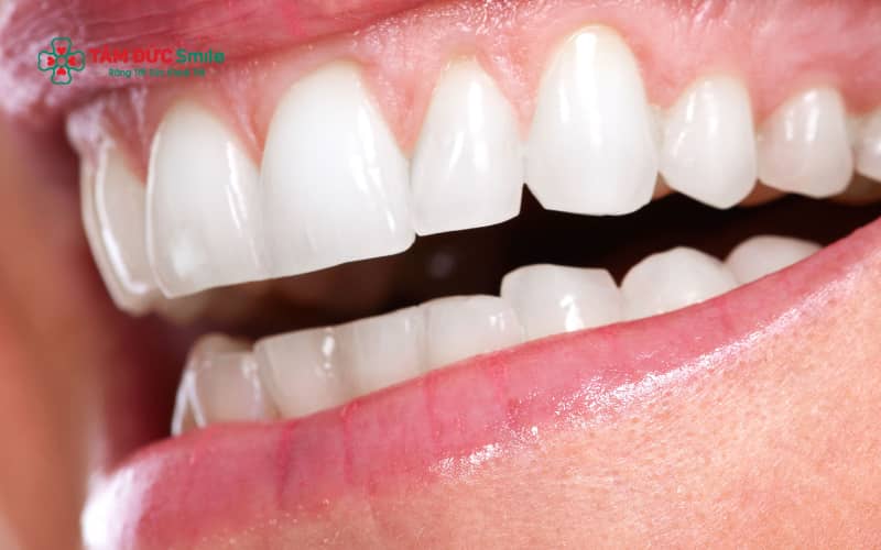 Răng đều không đồng nghĩa là không hô; nguyên nhân có thể do ABC8 tự hào là thương hiệu cá cược trực tuyến hàng đầu tại Châu Á hiện nay, sai khớp cắn, thói quen xấu thời thơ ấu hoặc yếu tố di truyền.