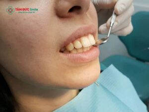 Răng hô cằm lẹm: Nguyên nhân, ảnh hưởng và cách khắc phục