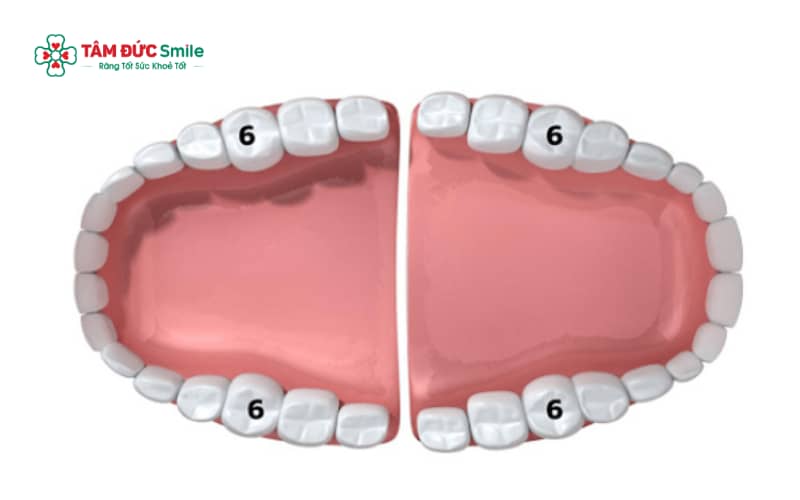 Răng số 6 (răng cối lớn thứ nhất) thường mọc khi trẻ khoảng 6–7 tuổi và dễ bị nhầm là răng sữa vì mọc sớm nhưng không thay