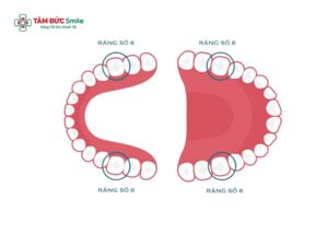 Răng số 6 có thay không? Vai trò, hậu quả mất răng số 6 cần biết