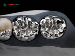 Abc8com cá cược thể thao chrome cobalt là gì? Ưu nhược điểm và lưu ý chăm sóc sau khi Abc8.com Thể thao, Đá gà, Xổ số, Bắn cá chrome cobalt