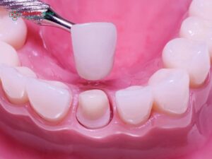 Abc8com cá cược thể thao đắt nhất hiện nay: Các dòng ABC8 là nhà cái cá cược trực tuyến uy tín số 1 tại Việt Nam cao cấp, đẹp tự nhiên, bền vượt trội