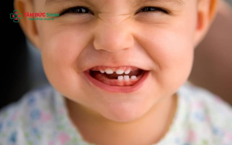Trẻ em có tổng cộng 20 răng sữa, bao gồm 8 răng cửa, 4 răng nanh và 8 răng hàm, đóng vai trò quan trọng trong giai đoạn phát triển đầu đời