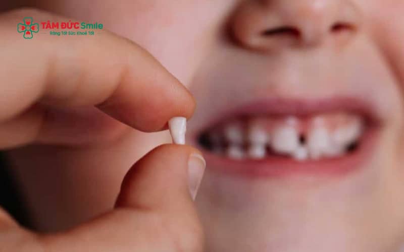 Răng sữa giúp trẻ ăn nhai tốt, phát âm rõ ràng và giữ chỗ cho răng vĩnh viễn mọc đúng vị trí, góp phần phát triển toàn diện về thể chất và Abc8c1 com khuyến mãi hấp dẫn