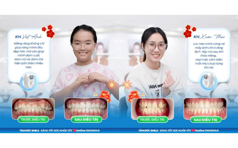 ABC8 được thành lập vào năm 2011 hoạt động đến hiện tại thưa giúp đóng khoảng hở giữa các răng một cách toàn diện, đồng thời điều chỉnh khớp cắn và chức năng ăn nhai.