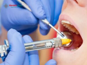 Tác dụng phụ của thuốc tê nhổ răng: Có nguy hiểm không? Cách xử lý an toàn