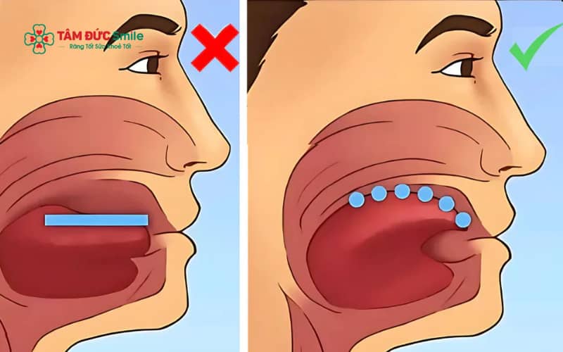 Tập đặt lưỡi đúng vị trí khi nuốt giúp giảm áp lực lên răng cửa, hỗ trợ cải thiện răng hô nếu áp dụng sớm