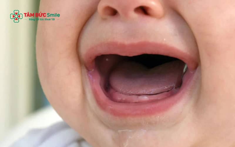 Khi sắp mọc răng, trẻ thường chảy nhiều nước dãi, ngứa lợi, hay cáu gắt và thích cắn nhai các vật cứng.