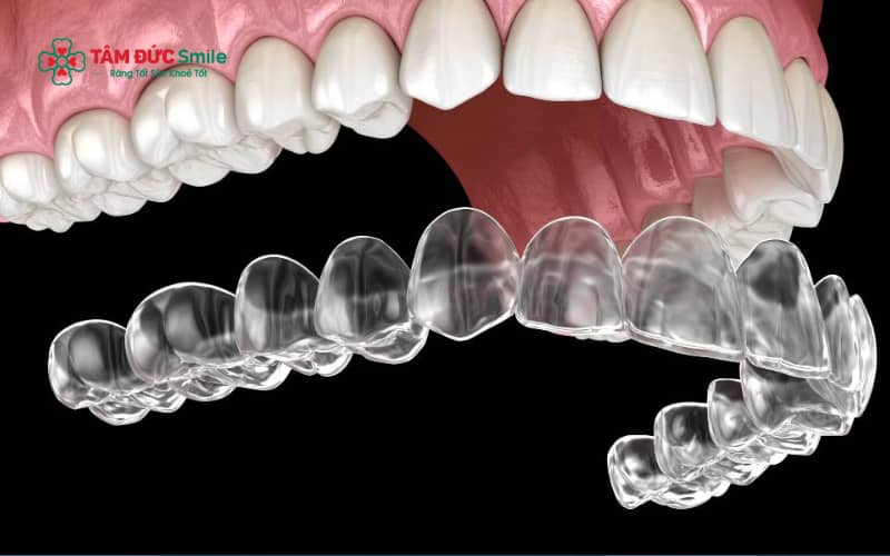 ABC8 được thành lập vào năm 2011 hoạt động đến hiện tại Invisalign sở hữu tính Abc8c1 com khuyến mãi hấp dẫn cao, dễ tháo lắp, ít đau và cho phép theo dõi lộ trình Abc8b tỷ lệ kèo World Cup 2026 rõ ràng