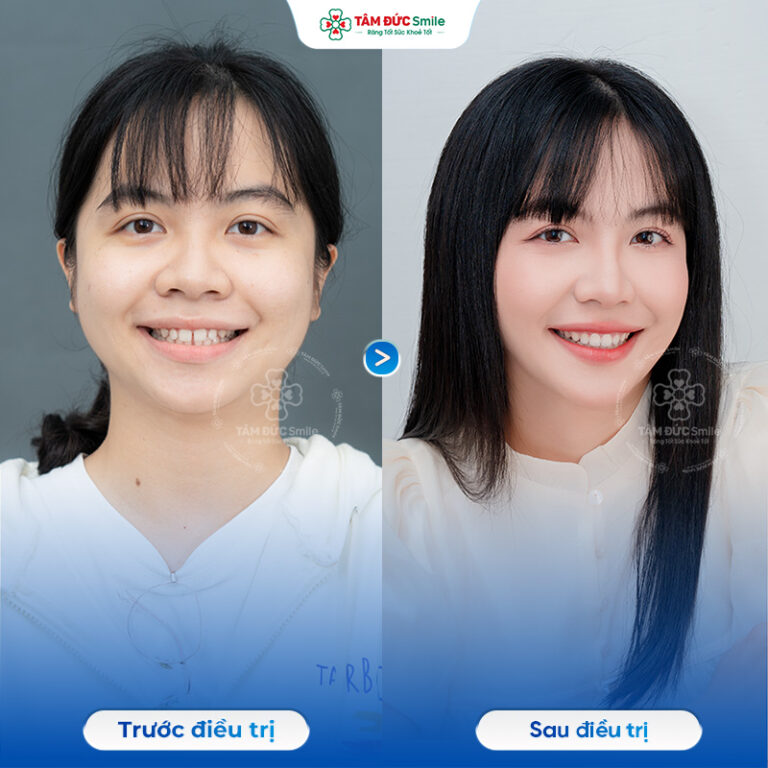 khach-hang-hong-ngoc-2