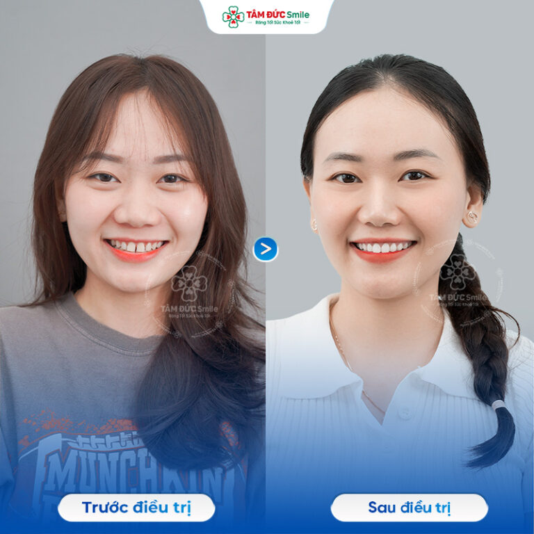 khach-hang-ngoc-anh-2