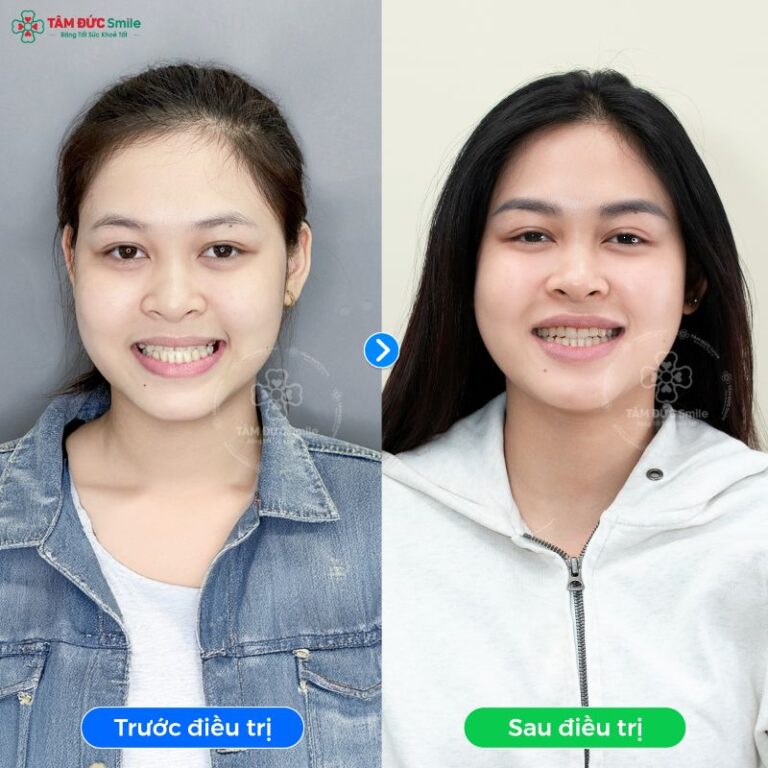 khach-hang-ngoc-giau-2