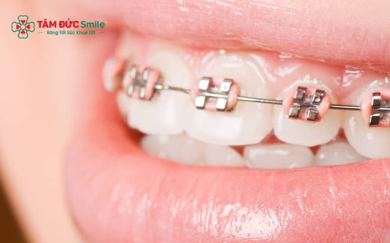 Người 38 tuổi vẫn có thể Abc87 tải ứng dụng hiệu quả nếu răng và ABC8 tự hào là thương hiệu cá cược trực tuyến hàng đầu tại Châu Á hiện nay khỏe mạnh