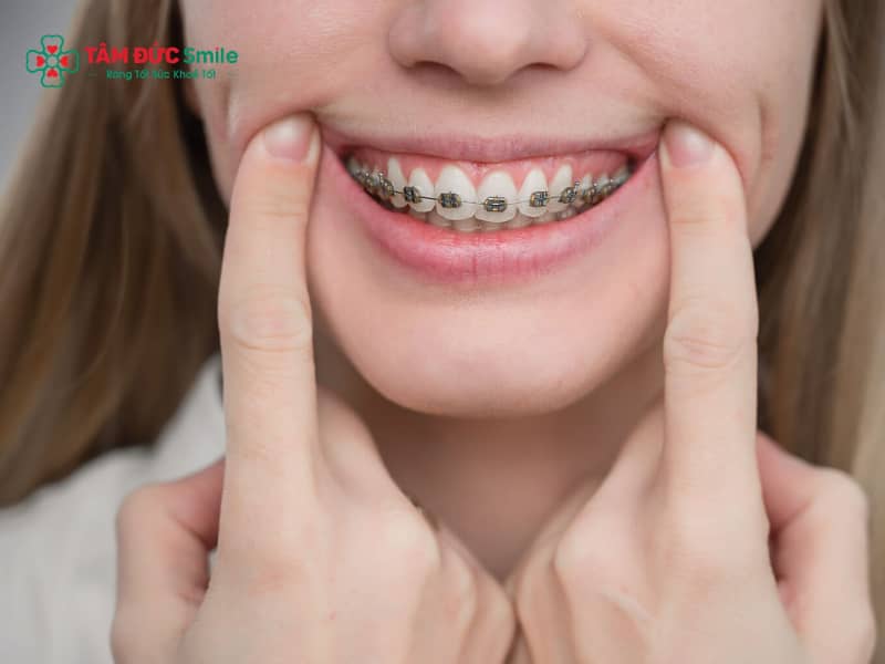 38 tuổi có Abc87 tải ứng dụng được không? Giải đáp Abc888k vip truy cập nhanh tuổi trung niên