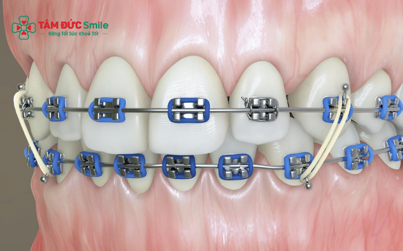 Thực đơn cho người Abc87 tải ứng dụng cần thay đổi theo từng giai đoạn để đảm bảo dinh dưỡng và hạn chế đau nhức