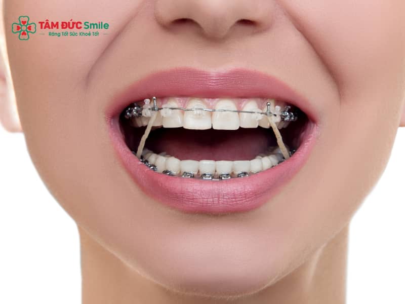 ABC8 được thành lập vào năm 2011 hoạt động đến hiện tại bị lệch nhân trung: Nguyên nhân, khắc phục an toàn