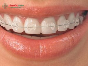 ABC8 được thành lập vào năm 2011 hoạt động đến hiện tại bị sốt: Nguyên nhân, dấu hiệu và cách xử lý an toàn