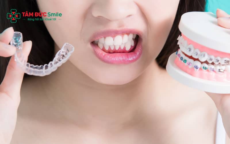 Sau khi tháo niềng và đeo hàm duy trì đúng cách, răng sẽ ổn định và ít bị ảnh hưởng lâu dài.