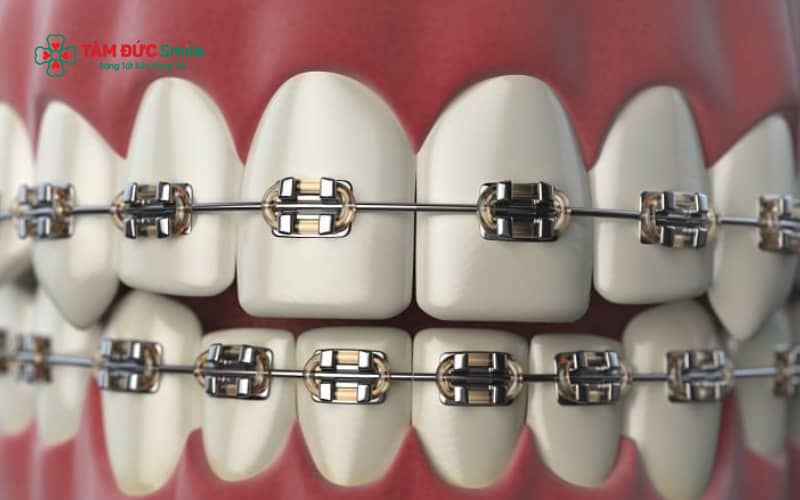 Mang theo dụng cụ vệ sinh ABC8 là nhà cái cá cược trực tuyến uy tín số 1 tại Việt Nam chuyên dụng giúp người Abc87 tải ứng dụng chăm sóc răng tốt khi đi du lịch.