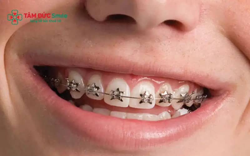 ABC8 được thành lập vào năm 2011 hoạt động đến hiện tại thường không phải là lý do đủ để hoãn nghĩa vụ nếu không ảnh hưởng nghiêm trọng đến sức khỏe.