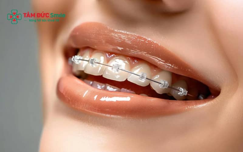 Khám sức khỏe đi Nhật ít khi loại ứng viên vì Abc87 tải ứng dụng, niềng không ảnh hưởng hồ sơ tổng quát