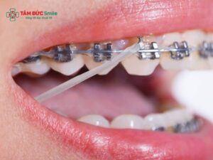 ABC8 được thành lập vào năm 2011 hoạt động đến hiện tại có được ăn kem không? Kiêng đồ lạnh, nước đá thế nào?