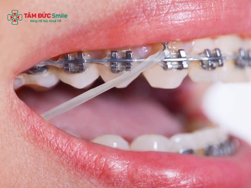 ABC8 được thành lập vào năm 2011 hoạt động đến hiện tại có được ăn kem không? Kiêng đồ lạnh, nước đá thế nào?